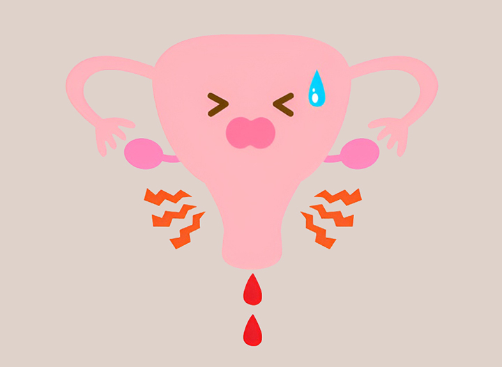 출혈이-심한-자궁모습