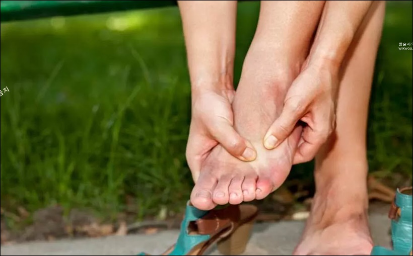 새끼발가락 류마티스관절염