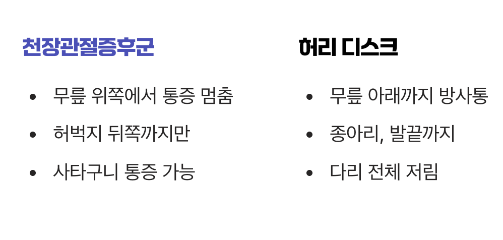 3. 허벅지 뒤쪽으로 뻗치는 저릿함 (디스크와의 차이점)