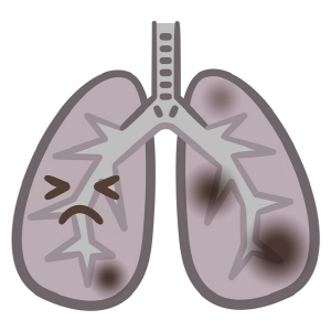 폐암 초기증상
