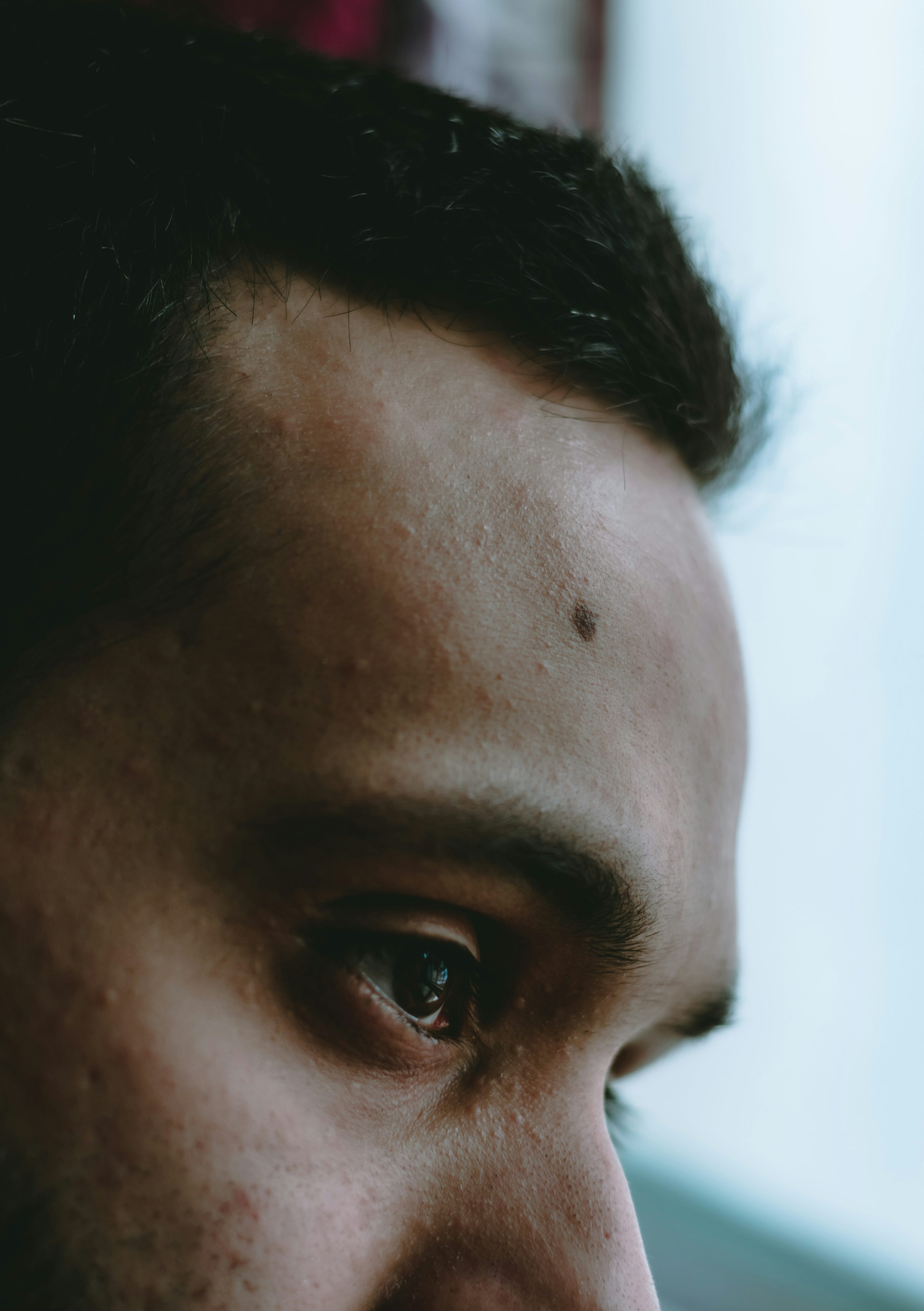 검버섯 없애는 방법