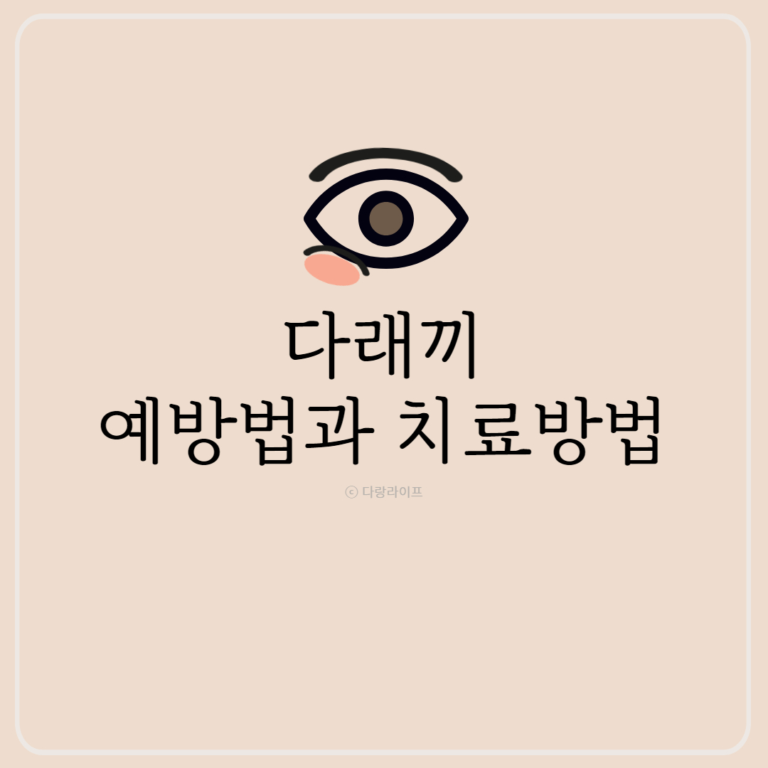 눈다래끼 예방법과 치료방법, 눈다래끼 빨리 낫는법