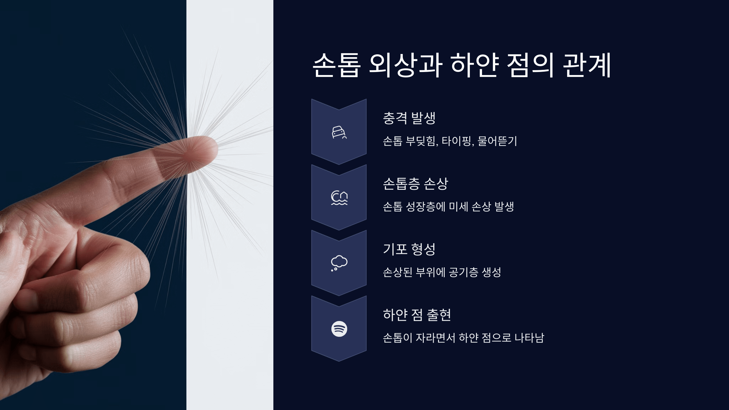 손톱 외상
