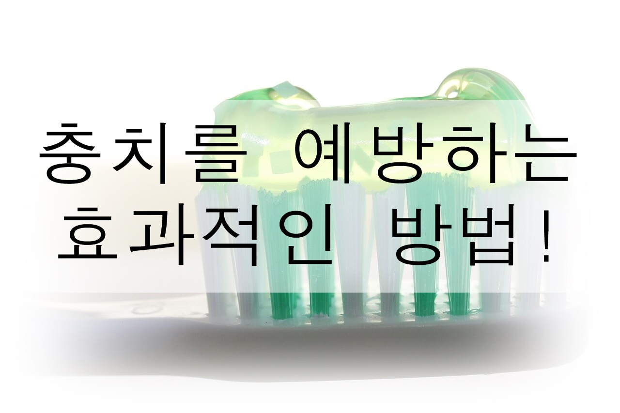 충치를 예방하는 효과적인 방법!