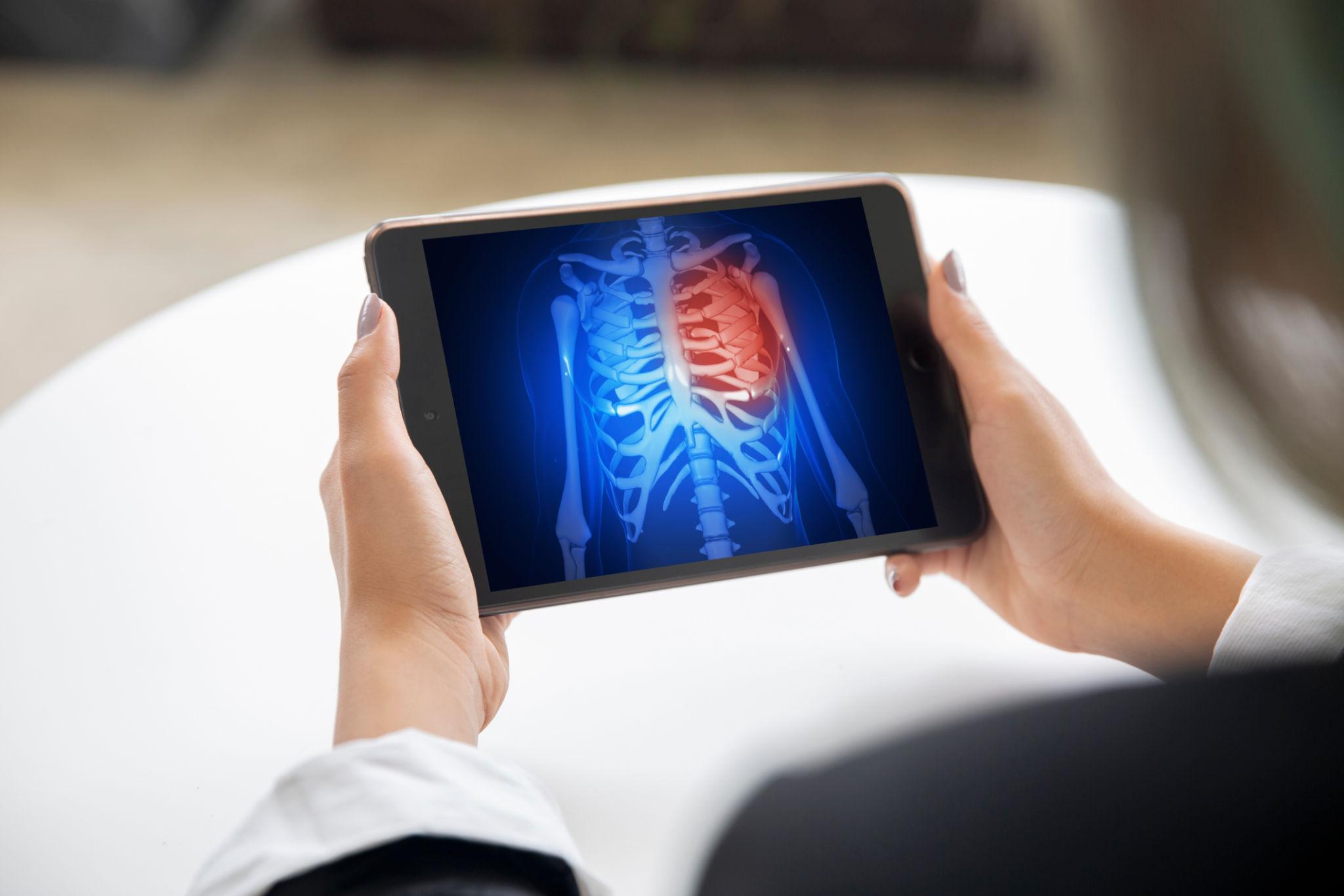 뼈가 약해지는 신호&hellip; 칼슘 음식 제대로 먹는 방법 총정리