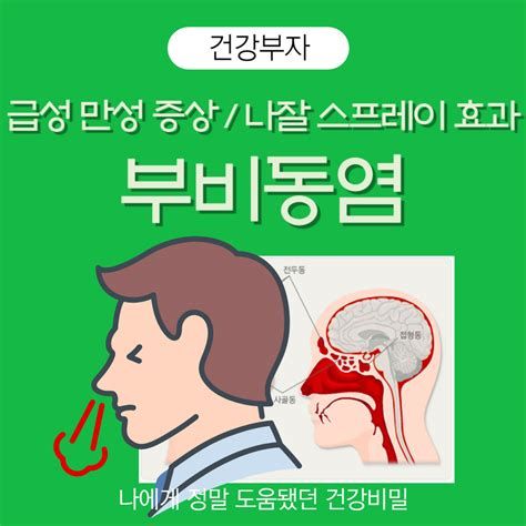 부비동염