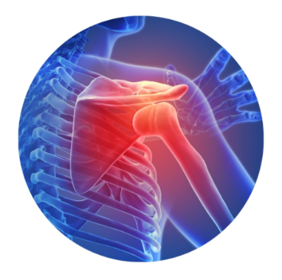 어깨관절과 관련된 사진