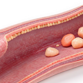 혈관 건강 위험