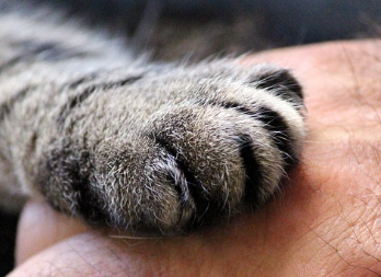 발톱이 검게 변하는 이유 7가지와 해결 방법 13