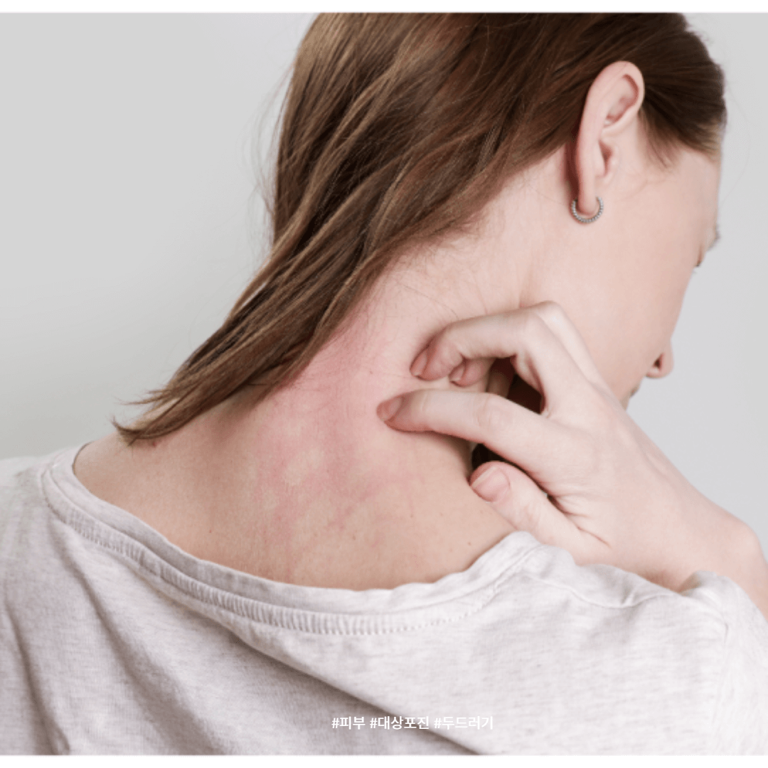 세비타비겔 가격 성분 사용법