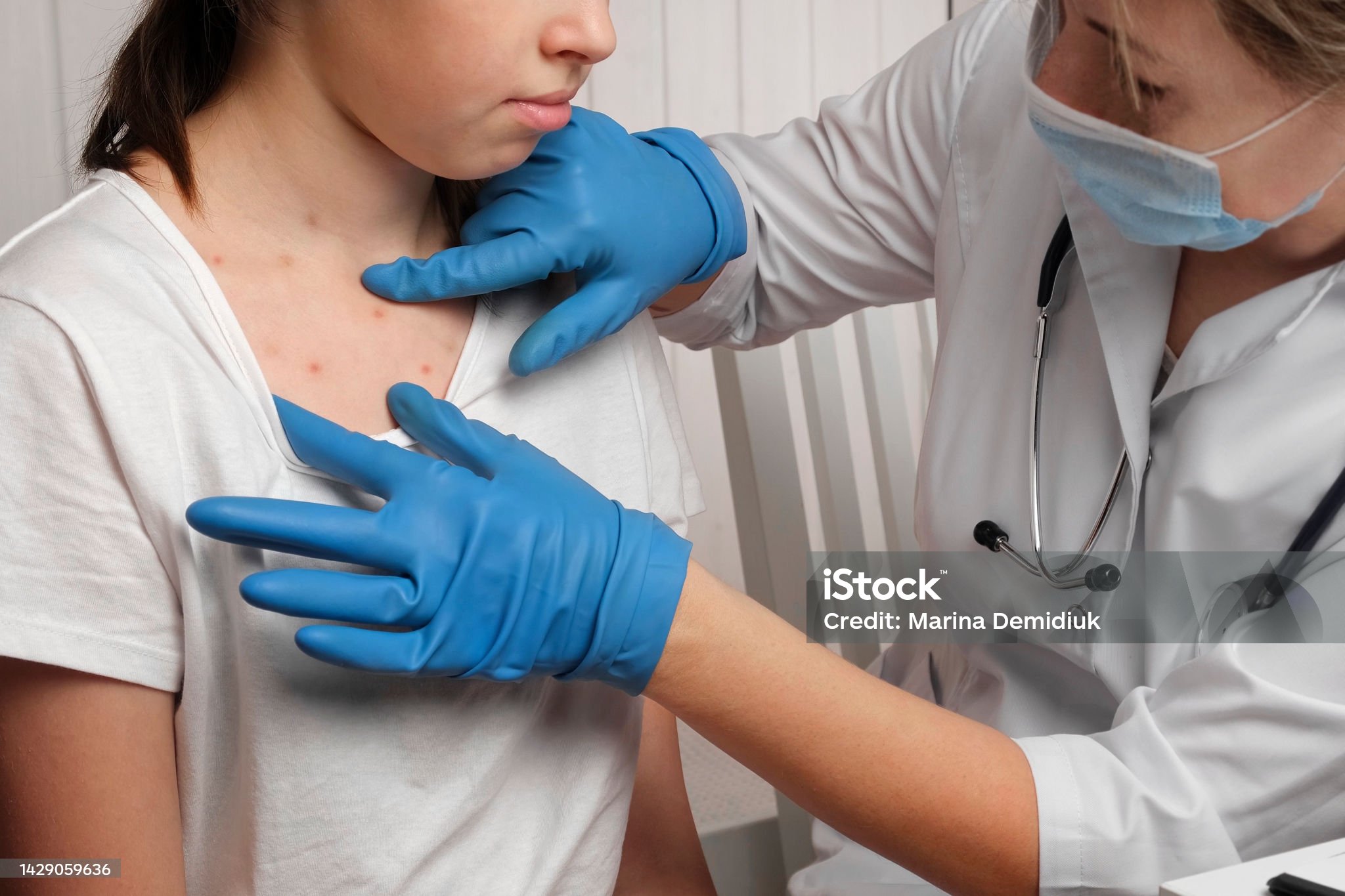 홍역 진단 방법과 검사 절차: 정확한 감별 진단법