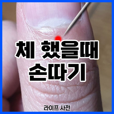 체 했을때 손따기