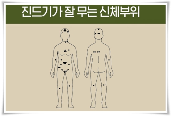 "진드기" 야외 활동의 숨은 적, 안전한 야외 활동을 위한 가이드!