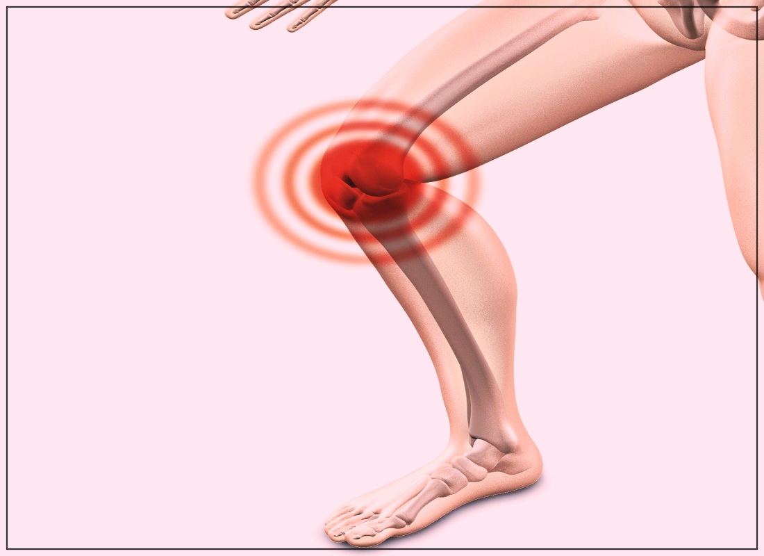 거위발건염 사진