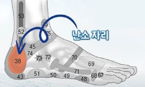 난소자리