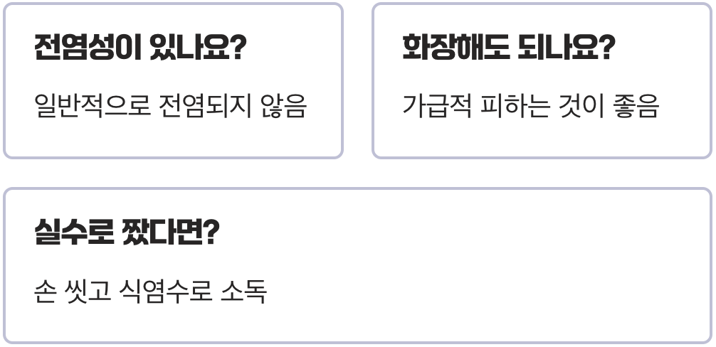 다래끼, 절대 손으로 짜면 안 되는 이유와 흉터 없이 고름 자연 배출시키는 법