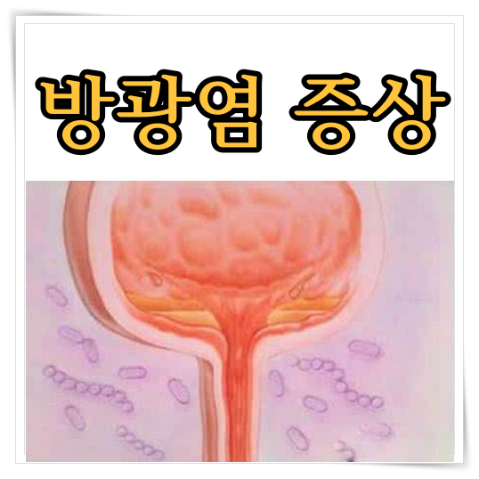 방광염 증상