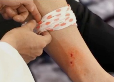 뱀에-물렸을때-응급처치