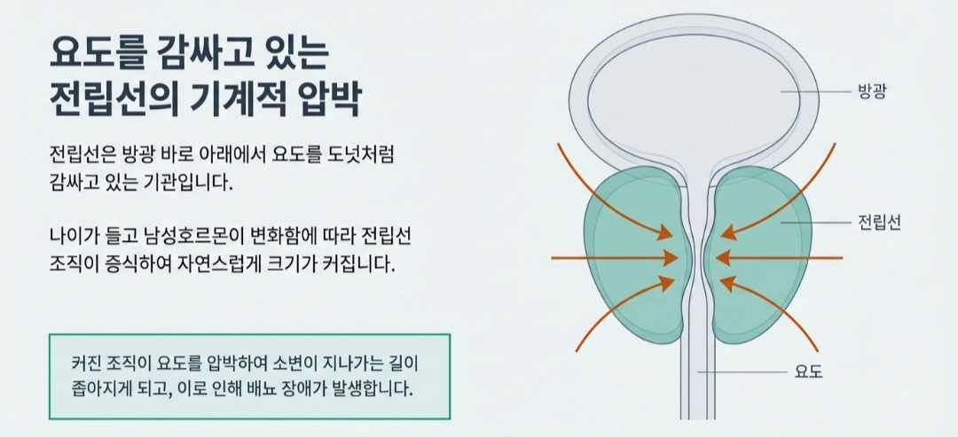 전립선비대증증상-사진8