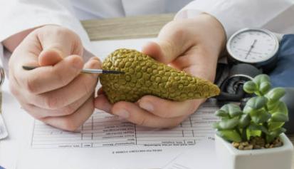 췌장암 초기증상 검사방법 발생원인 총정리(최신)