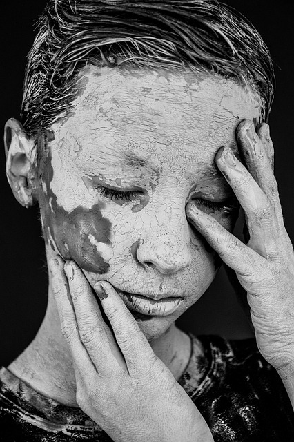 얼굴에-백반증이-있는-여성이-얼굴을-만지고-있습니다.