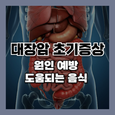 대장암 초기증상
대장암 원인
대장암 예방
대장암에 좋은 음식
대장암 예방법
대장암 증상
대장암 검진
대장암 예방 식단
대장 건강 관리