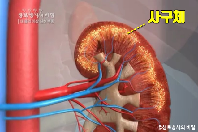 종아리 얼굴 붓는 이유, 붓기 부기 부종 원인 증상, 생로병사의 비밀, 다이어트 건강, 팁줌 매일꿀정보