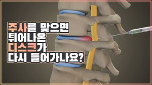 허리디스크 신경주사