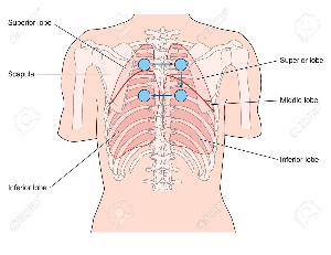 폐위치