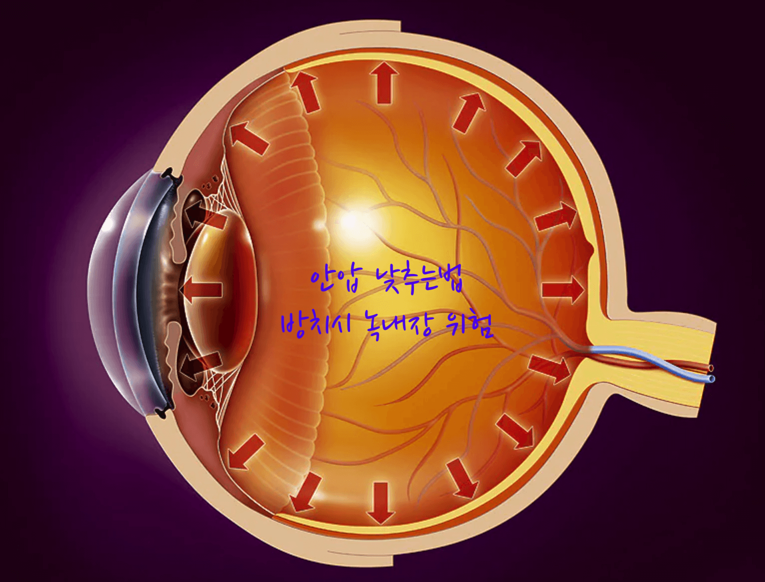 안압 낮추는법