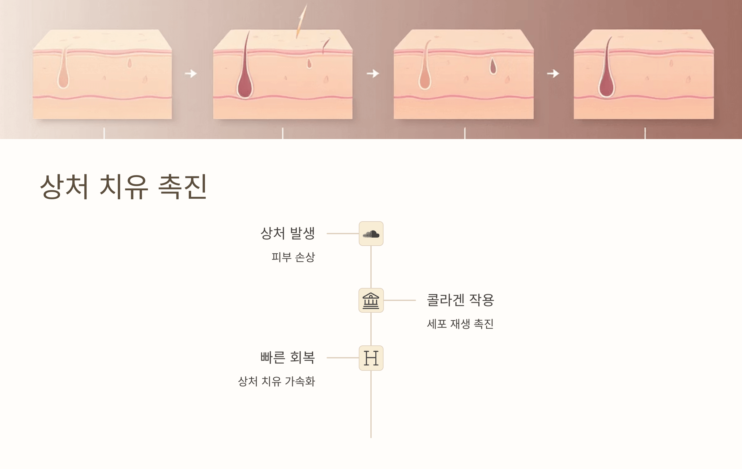 난각막 사진입니다.