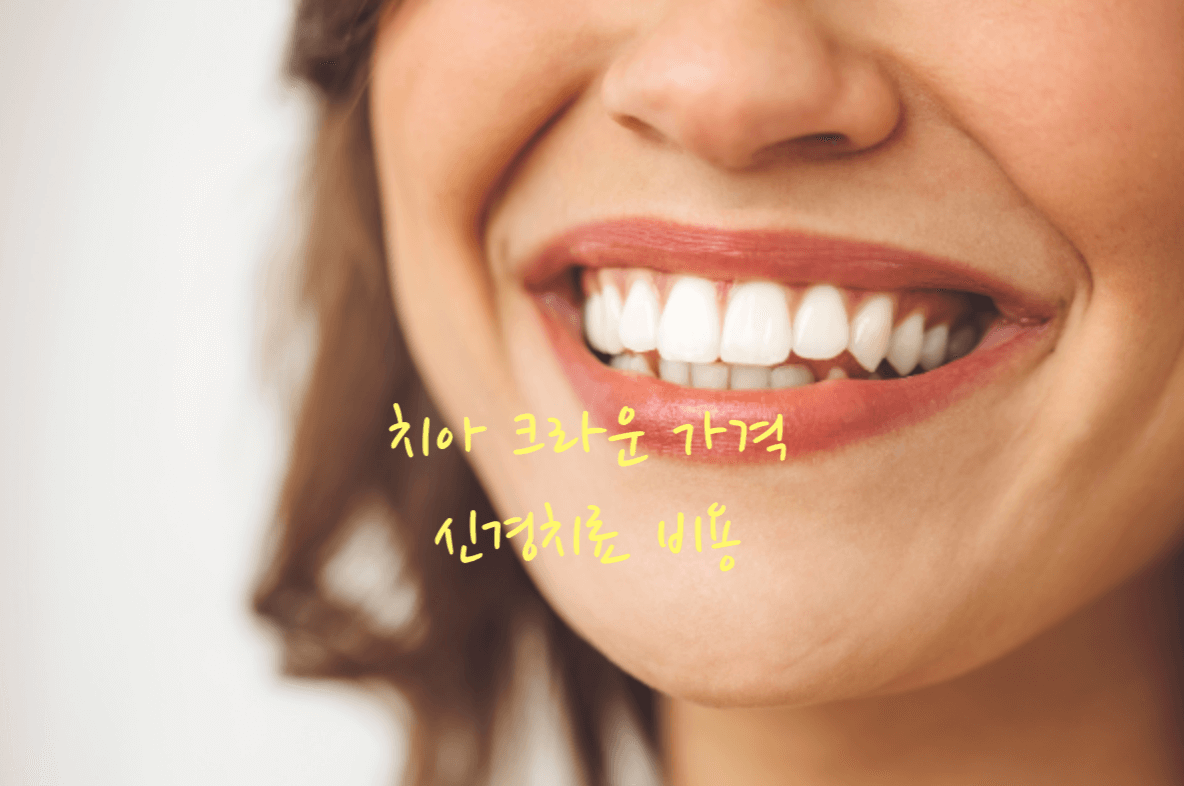 치아 크라운 가격