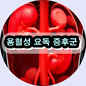 용혈성 요독 증후군,
용혈성 요독 증후군 증상,
용혈성 요독 증후군 치료 방법,
용혈성 요독 증후군 자연 요법,
HUS 증상과 예방법,
전형적 vs 비전형적 용혈성 요독 증후군,
용혈성 요독 증후군 후기,
용혈성 요독 증후군 예방,
용혈성 요독 증후군 신장 회복,
용혈성 요독 증후군 보체 억제제,