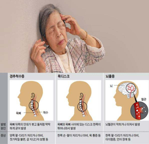 경추통증