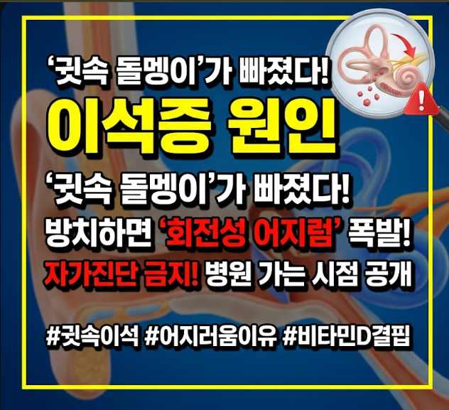 이석증 원인