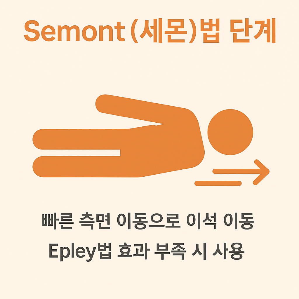 세몬법의 빠른 측면 이동을 통해 이석을 이동시키는 방식과 Epley법 효과 부족 시 보조 치료로 사용하는 방법 안내