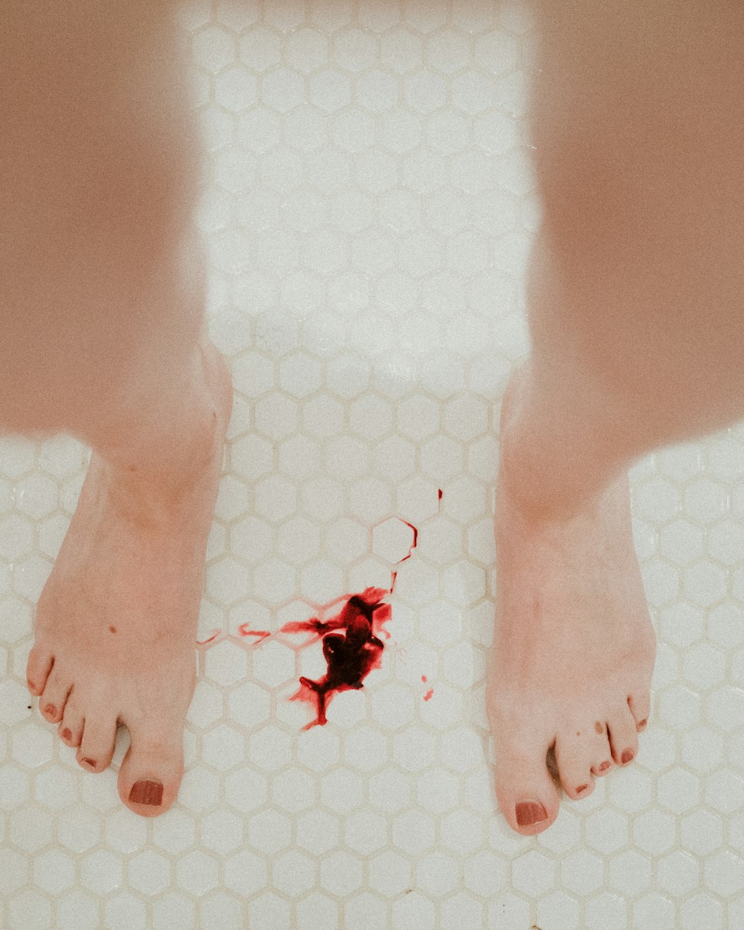 생리늦어짐: 원인과 대처 방법 총정리 관련 이미지 2