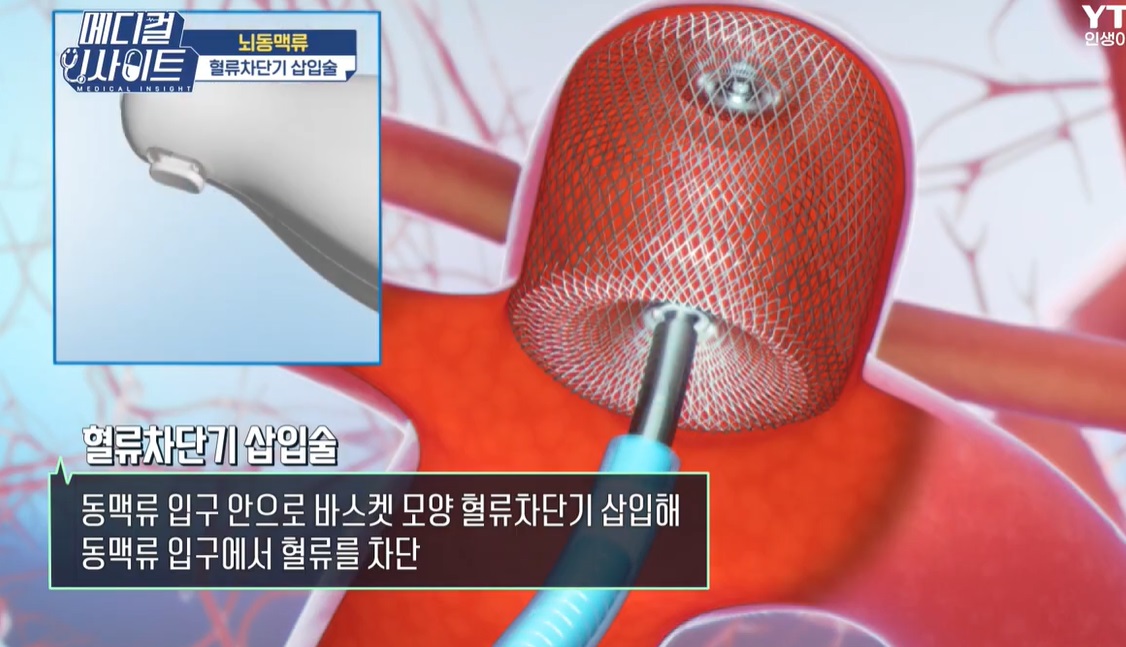 신경외과-윤원기-교수-