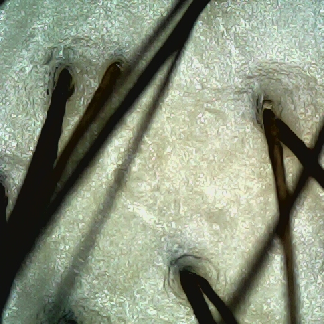 탈모 극복 프로젝트 - 정수리 두피 모습이다.