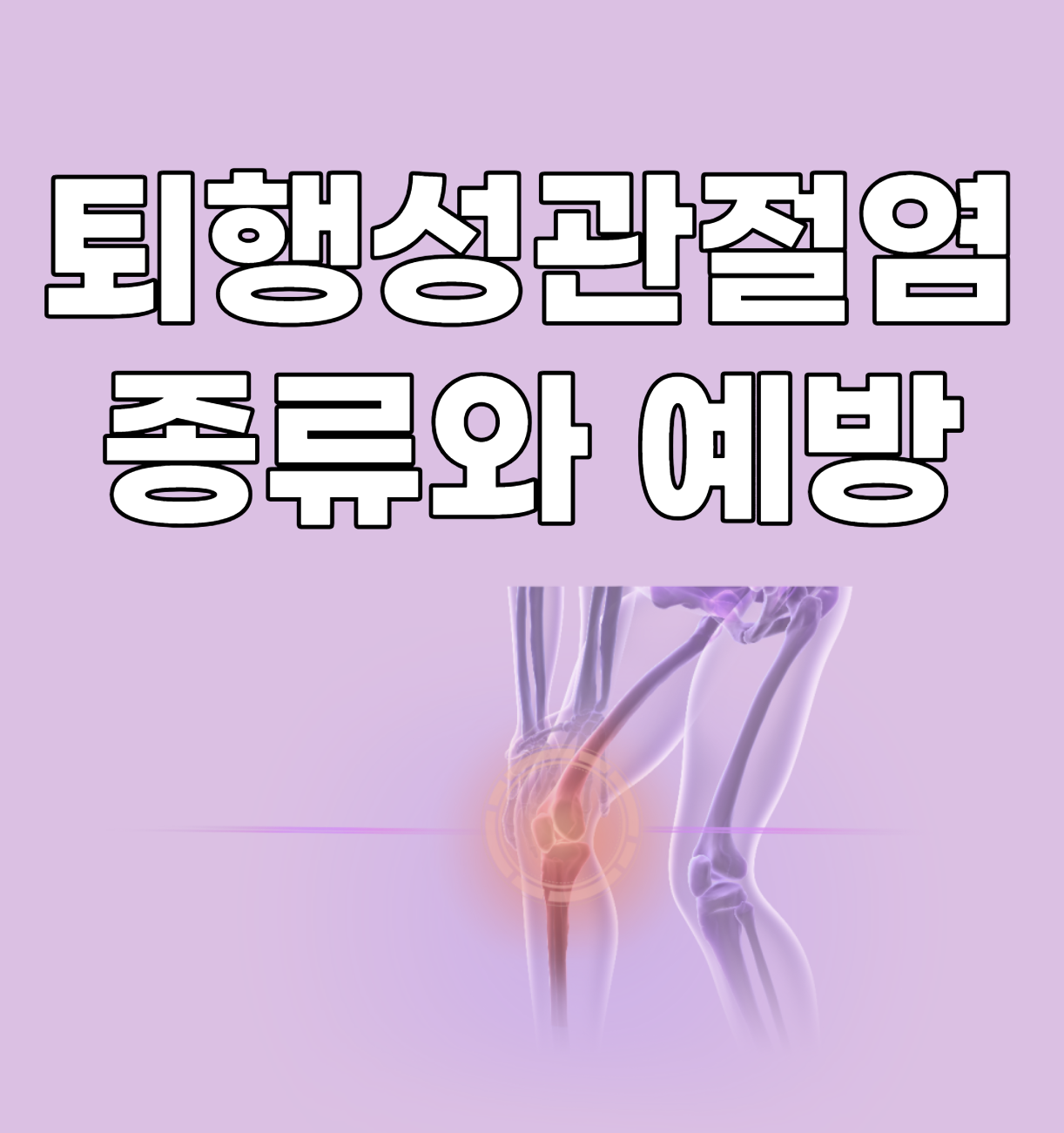 퇴행성관절염 대체 이미지