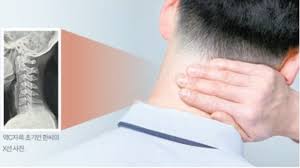 뒷골이 땡기는 증상