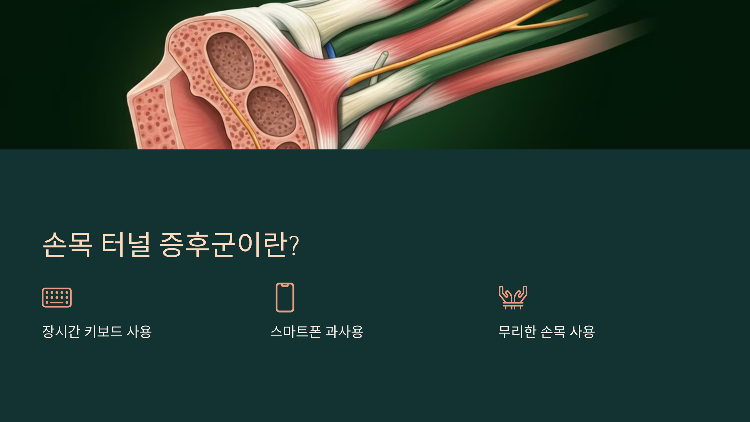 1. 손목 터널 증후군이란?