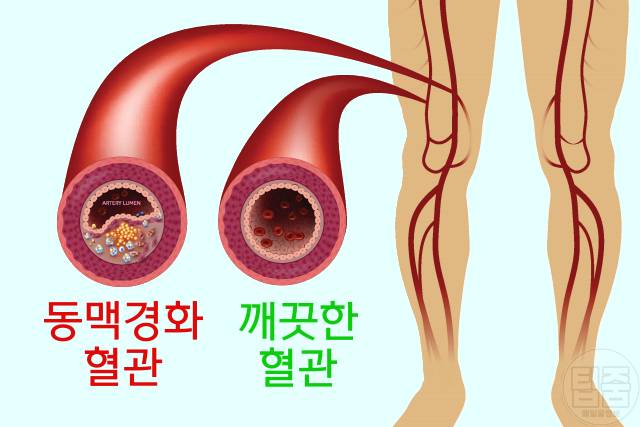 대추 매일 먹으면 3개 대추효능 중성지방 동맥경화