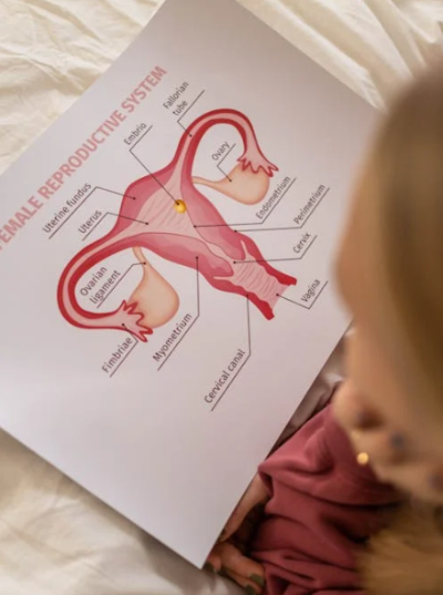 자궁근종 관련 사진