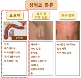 std 12종 검사 완벽 총정리종류 비용 등으로 검사항목_5