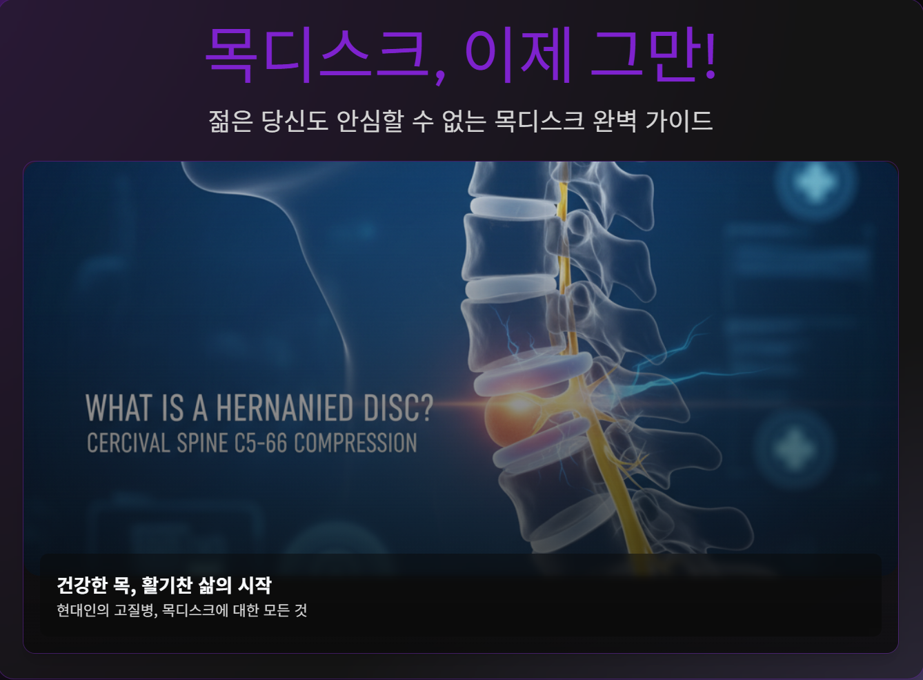 목디스크, 이제 그만!젊은 당신도 안심할 수 없는 목디스크 완벽 가이드
