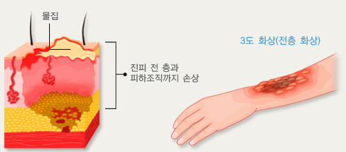 3도 화상의 설명