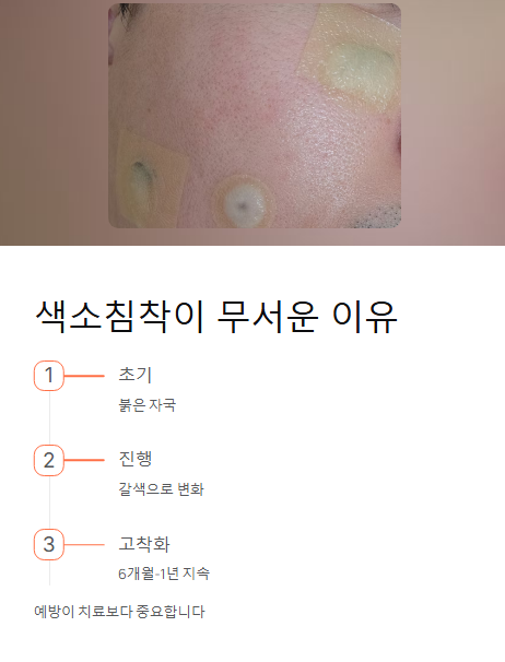 색소침착이 무서운 이유
