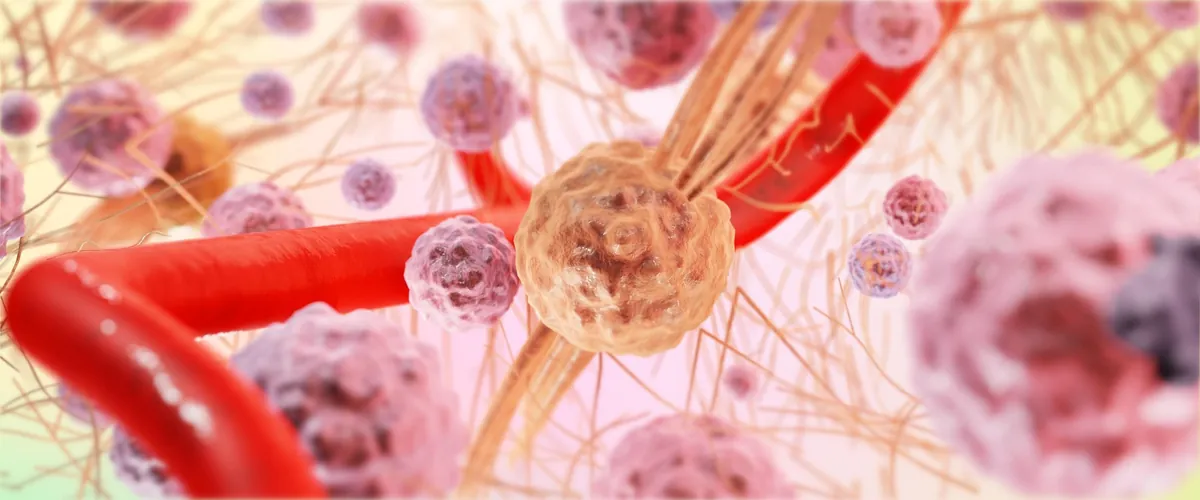 30대 암건진 우선순위 체크리스트 TOP5