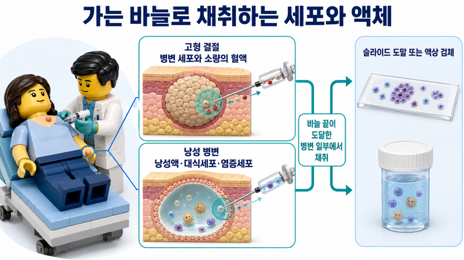 고형 결절과 낭성 병변에서 가는 바늘로 세포와 액체를 채취해 슬라이드 도말 또는 액상 검체로 처리하는 과정